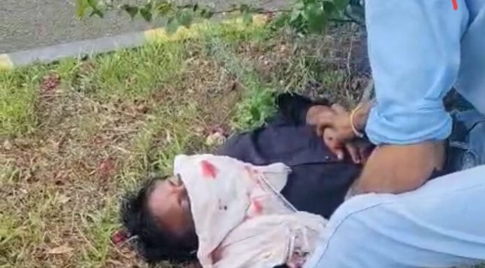 पांढुर्णा: आखिर कैसे टकराई दो बाइक, जबड़ा ओर दांत टूटे,सिर पर भी गंभीर